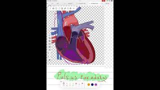 Pulsus paradoxus normal physiology how to measure and pathology [upl. by Swerdna594]