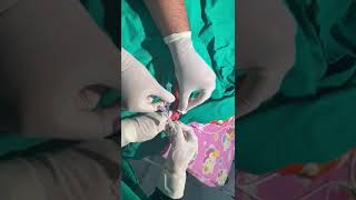 picc line insertion procedure guide dr900 gm baby ko picc line dali nicu meVicky tirgar [upl. by Dyol]