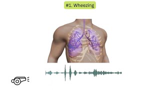 Abnormal lung sounds in COPD [upl. by Nahshunn]