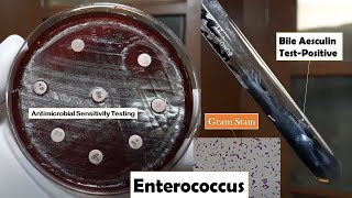 Enterococcus Antibiotics sensitivity testing bile esculin positive and Gram staining [upl. by Choong389]