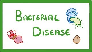 GCSE Biology  What Are Bacterial Diseases  Treatment and Prevention 37 [upl. by Prem936]