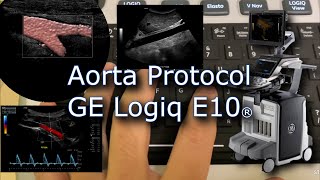 Aorta Protocol Logiq E10 [upl. by Eikcir]