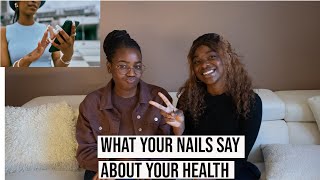 What do your Nails say about your HealthNail signs 101 [upl. by Jandy]