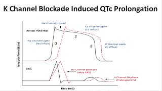 Medical Mythbusters – Haloperidol and QTc Prolongation [upl. by Deanna]