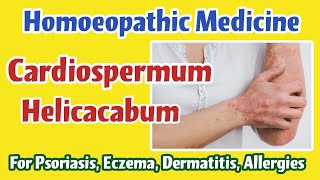 Cardiospermum Helicacabum Homoeopathic Medicine for Psoriasis Eczema Dermatitis Allergies [upl. by Acinorej]