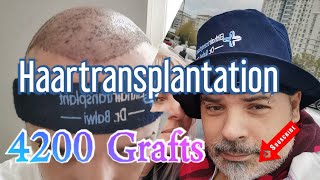 Meine Haartransplantation bei Elithairtransplant Istanbul Erfahrungen Und Erlebnisse incl Teil 1 [upl. by Akinorev]