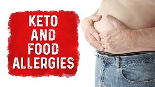 Food Allergies VS Digestion Issues on Keto Diet – DrBerg [upl. by Nnyladnarb]