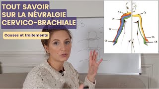 NÉVRALGIE CERVICOBRACHIALE  cause et symptômes pour mieux agir ensuite [upl. by Ethelda]