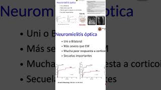 Neuromielitis Óptica [upl. by Durgy368]