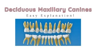 Deciduous Maxillary Canine  Dental Morphology of Primary Maxillary Canines [upl. by Bilski521]