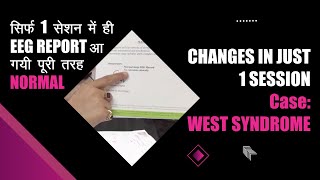 Changes in just 1 Session  2nd Case  West Syndrome  1 सेशन में EEG रिपोर्ट आ गयी पूरी तरह Normal [upl. by Alphonse216]