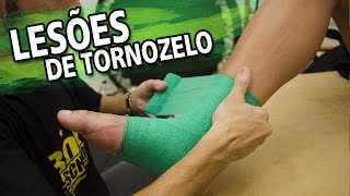 Como tratar lesões de tornozelo Fisioterapia Esportiva  RTF 111 [upl. by Coco146]