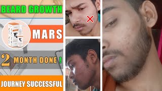 BEARD GROWTH  FROM MARS BY GHC MINOXIDIL  2 Month done 👍 beard journey successful [upl. by Ellison]