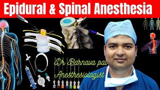 Epidural Anesthesia amp Spinal Anesthesia [upl. by Anneh890]