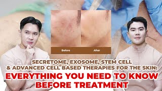 Secretome Exosome Stem Cell amp Advanced Cell Therapies for the Skin Everything you need to know [upl. by Eilerua]