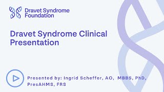 Dravet Syndrome Clinical Presentation [upl. by Llertram]