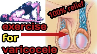 varicocele exercise  varicocele exercise treatment  yoga for varicocele  Hindi [upl. by Ahsiadal703]