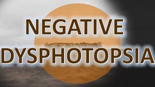 Negative Dysphotopsia  Management with the ND Ring [upl. by Ila73]