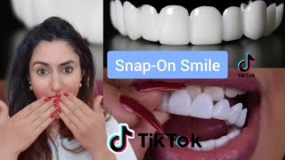 Orthodontist Reacts To SnapOn Veneer TikToks [upl. by Ardnuaed]