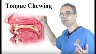 Tongue Chewing By Dr Mike Mew [upl. by Bohi]