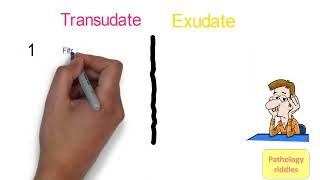 Edema Pathology Part  3 Hemodynamics Transudate versus Exudate Fmge Neet PG usmle Pathology Notes [upl. by Yonah193]