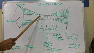 optometry insights Sturms conoid [upl. by Dirgni]