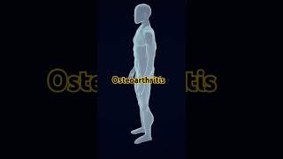 Osteoarthritiscausestreatment osteoarthritis viralshorts 3danimation crazypharmaguruji [upl. by Latreece]