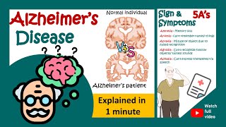 Alzheimers disease in 1 minute  1minute pathology Pathological hallmarks of Alzheimers disease [upl. by Ledah446]