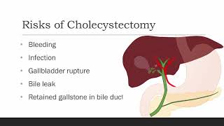 What is Laparoscopic Cholecystectomy [upl. by Stuart388]