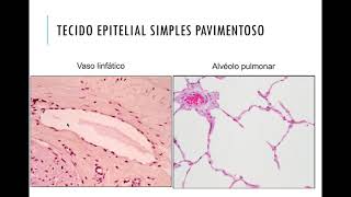 3 Tecido epitelial de revestimento classificacÌ§aÌƒo meÌdio [upl. by Hadnama]