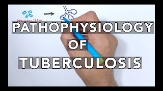 Pathophysiology of Tuberculosis [upl. by Feledy]