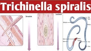 How Trichinella Spiralis Can Transform Your Body Ahmaric Tutorial [upl. by Atteirneh]