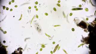 Wimpertierchen  Ciliophora  Hypotrichida  Ciliata  microorganisms under microscope [upl. by Ydnor]