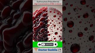 High level of RBC in Blood 😰  Erythrocytosis polycythemia Explained 🤔 rbc erythrocytes shorts [upl. by Suoilenroc]