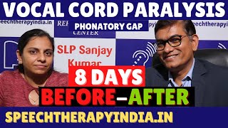 BeforeAfter  Vocal Cord Paralysis Treatment  Phonatory Gap  Within 8 Days  By slpsanjaykumar [upl. by Eninotna861]