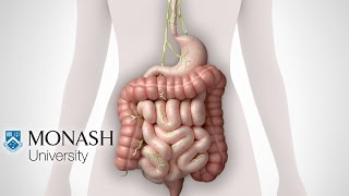 IBS symptoms the low FODMAP diet and the Monash app that can help [upl. by Enneiviv]