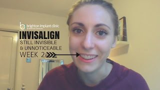 Invisalign Treatment Vlog After 2 weeks [upl. by Masera]