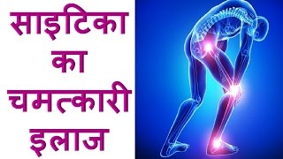 How To Relieve Sciatica Pain Naturally  साइटिका‬ का चमत्कारी इलाज [upl. by Oalsecnew]