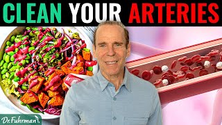 Can a Nutritarian Diet Remove Calcified Plaque in Arteries  Dr Joel Fuhrman [upl. by Gierc]