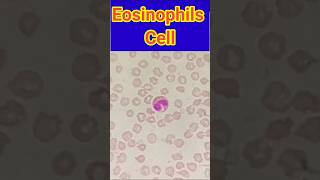 Eosinophils cells  Blood smear  Blood smear microscopy  shorts trendingshorts viral lab [upl. by Yvon]