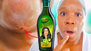 I Used AMLA OIL On My Skin Everyday FOR 12 DAYS [upl. by Cyna]