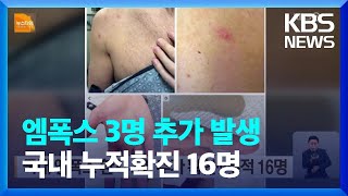 국내 엠폭스 환자 3명 추가 확인…누적 16명  KBS 20230418 [upl. by Aihsyn]