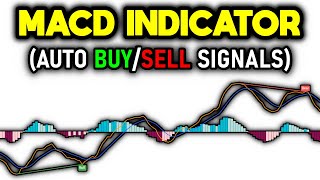 Special MACD Indicator Revealed Auto Signals [upl. by Eanod574]