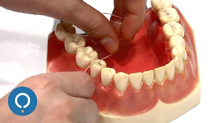 Como usar o fio dental corretamente [upl. by Etnwahs]