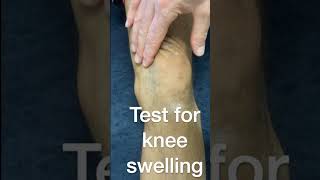 Test for knee swelling [upl. by Velma]