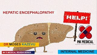 Hepatic encephalopathy [upl. by Nilyac]