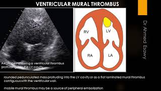 echocardiography made easy all thing you want to know video book silent video [upl. by Fairweather]