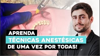 Guia Completo Técnicas Práticas de Anestesia em Odontologia [upl. by Ailekahs]