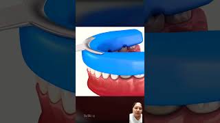 Cavity Removal and Crown Replacement satisfying dentition dentalscaling animation dentalcare [upl. by Lemak902]