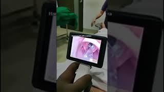 Video laryngoscope intubation [upl. by Lativa]